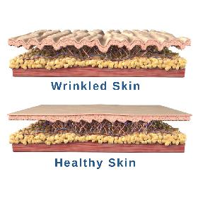 Skin Cross Section 3D model